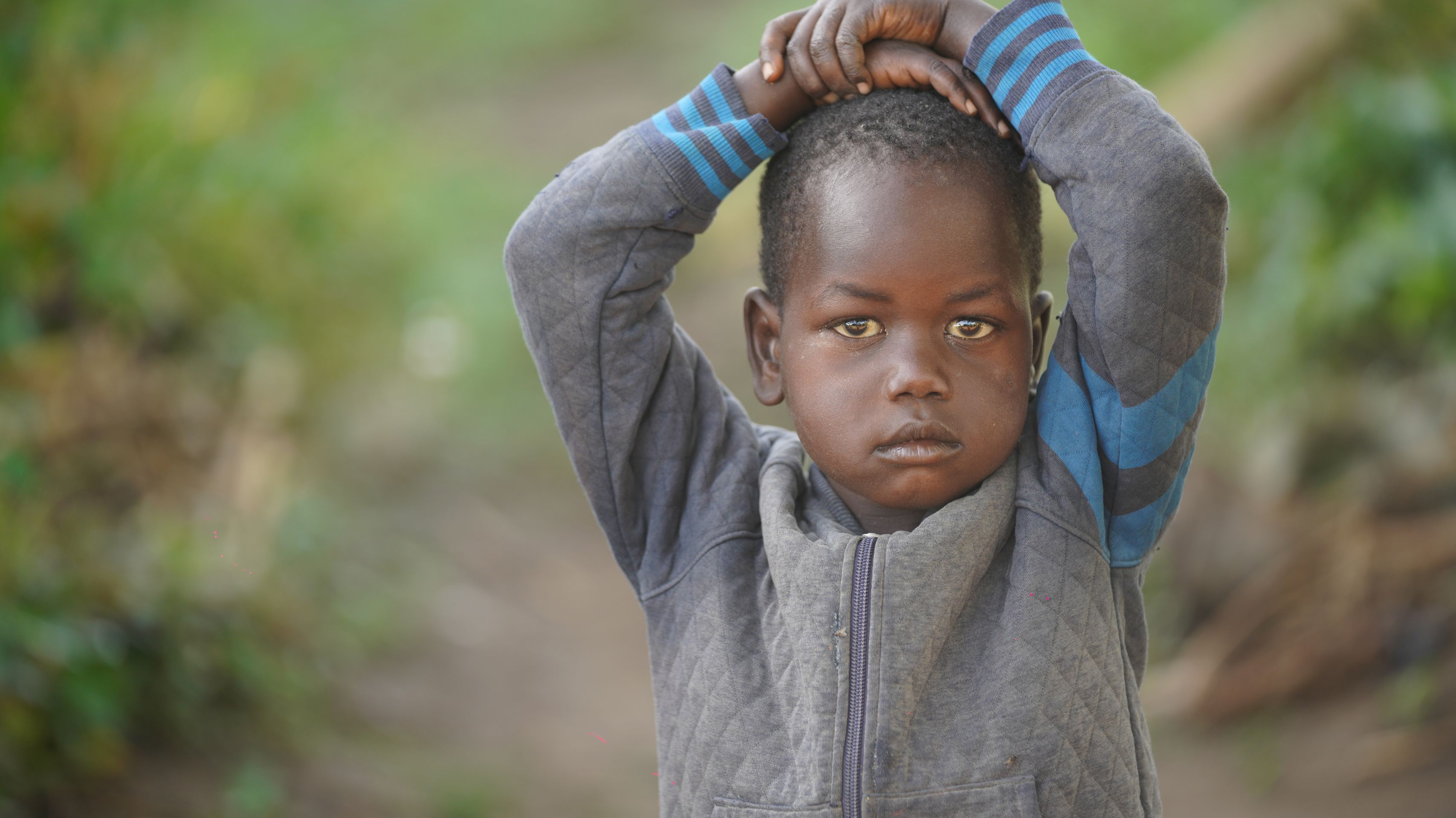 Ein kleines Kind mit dunkler Haut und ernsten Augen, Hände auf dem Kopf verschränkt, trägt eine graue Jacke vor grünem Hintergrund.